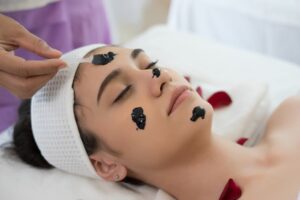 Carbon Laser Facial